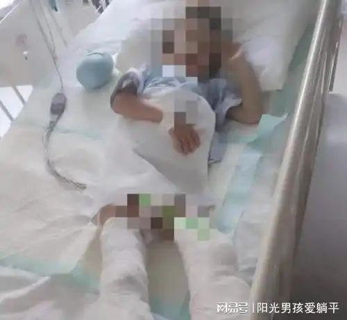 气愤江苏南通5岁男童被长期虐待致使截肢,生母获刑6年9个月