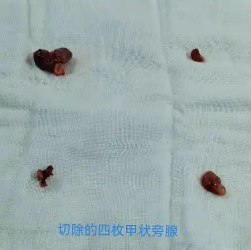 47岁男子全身瘙痒骨痛不止,医院检查后还发现了其他异常