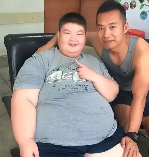 江西14岁男孩体重300斤,过度肥胖英年早逝,临终愿望令人唏嘘