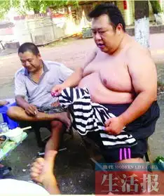 184公斤男子经缩胃手术减到90公斤现已结婚