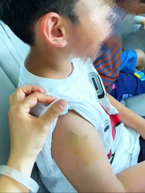 北京又现猕猴7岁男孩民宿内玩耍被咬伤,为何一个多月抓不到泼猴