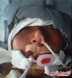 13岁男孩被蜱虫咬伤1个月后发病生命垂危