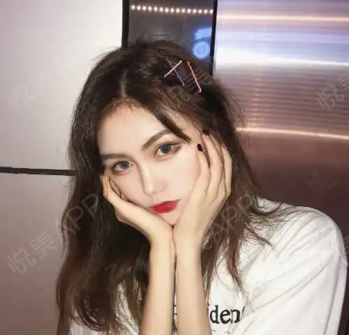 顺利恢复三个月啦开心鼻子现在已经没有啥问题啦,...鼻综合悦美整形