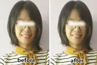 真人解析你以为用头发遮脸,脸就小了
