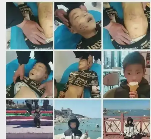 丧尽天良5岁男孩被亲妈和男友虐待致死警方介入,母亲身份曝光