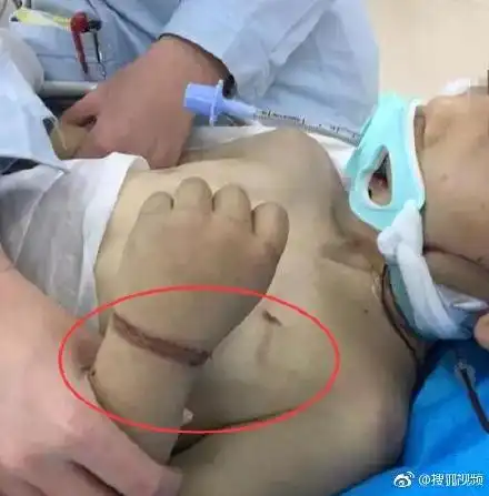 男孩被虐待成植物人,继母被判16年,生母抗诉,法院量刑适当