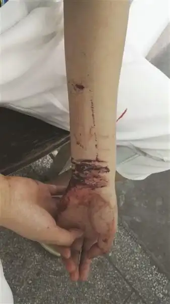 女孩报警称割腕自杀后关机泰兴民警苦寻2小时终于找到她