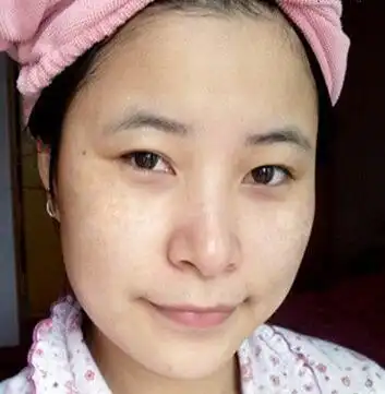 夏季涂防晒霜,想变白变美请先避开2大误区,别忽略了