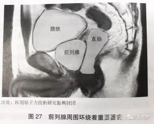 男性前列腺癌患者激增,重离子治疗效果极佳