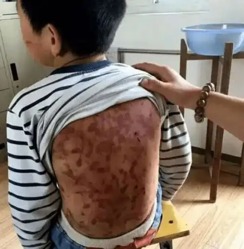 臭小子,让你丢人13岁男孩被后爸毒打1小时,母亲含泪报警