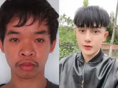失业丑男9次整容撞脸张东健,大方晒整容前丑照,人生意外改变