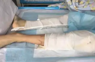 男孩因玩王者荣耀被骂4楼跳下,送医刚醒就想登录游戏