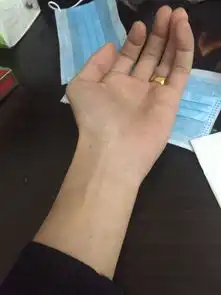 帮我ps成割手腕流血图片急用真实点,不要夸张
