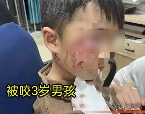 3岁男孩被狗咬伤后续注射疫苗后去世,母亲悲痛发声,评论沦陷
