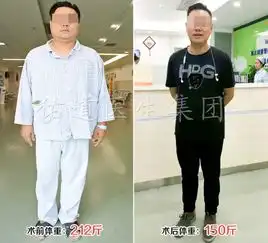 胖了很多年想减肥,胃旁路手术有用么