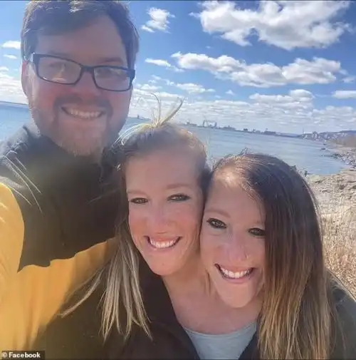 美国34岁连体双胞胎姐妹之一结婚,本人是老师,丈夫是男护士