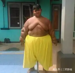 世界最胖男孩印度10岁男孩体重达384斤裤衩可比裙子
