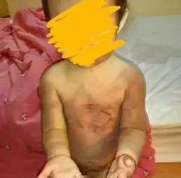 男子虐待女儿发图给前妻炫耀警方介入调查