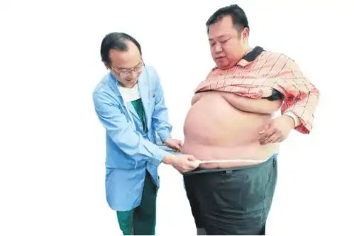 广西第一胖胖470斤面临生命威胁缩胃手术救命手术