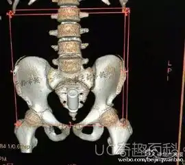 母亲为大学生女儿准备套套,该不该呢