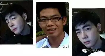 搜狐公众平台泰国励志boy花14万换头,他都整了哪里把每一分钱都花在了刀刃上
