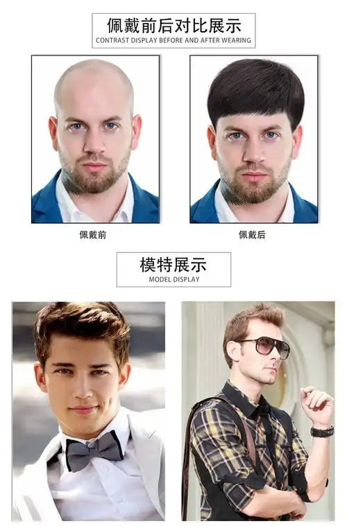 汤河店男士假发补发块pu生物头皮补发片真人发头顶补发隐形无痕