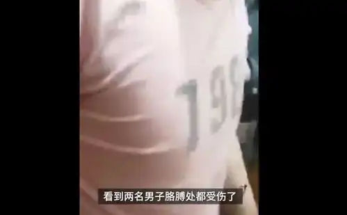 俩男子结拜割手腕血流不止,报警求助想效仿古人结义,不小心割深了