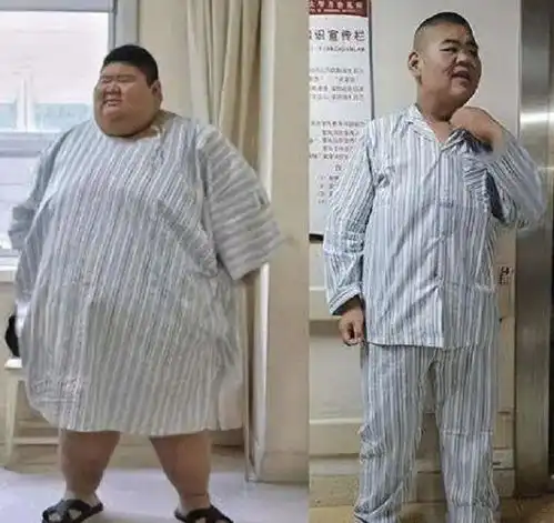 19岁男孩重达668斤,成为中国第一胖,减肥一年后,惊艳亮相