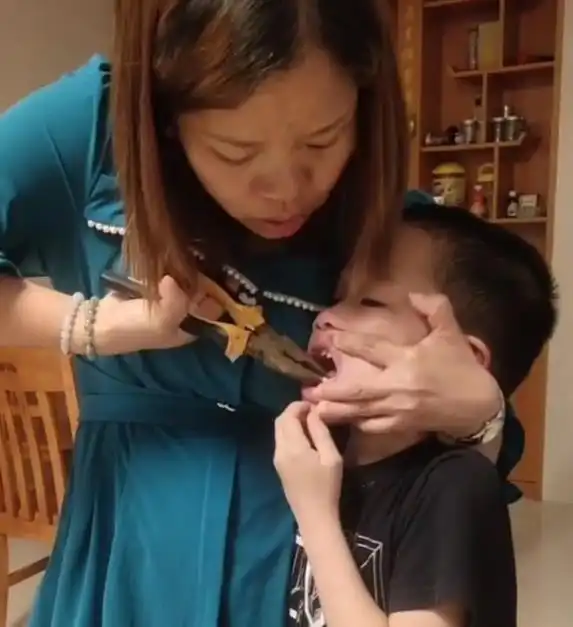 母亲在家里用老虎钳给儿子拔牙,硬核操作吓哭男孩,看呆网友