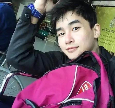 24岁男星患皮肤癌去世,生前左腿变黑遭截肢,病入膏肓仍笑对生活
