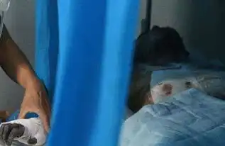 13岁少年烧伤女教师烧伤如何紧急处理