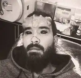 真有人整成了美国队长中的红骷髅,怪恐怖
