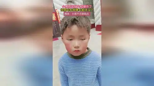 小男孩因打火机爆炸了,把眉毛和眼睫毛都烧没了,网友小孩千万别玩火